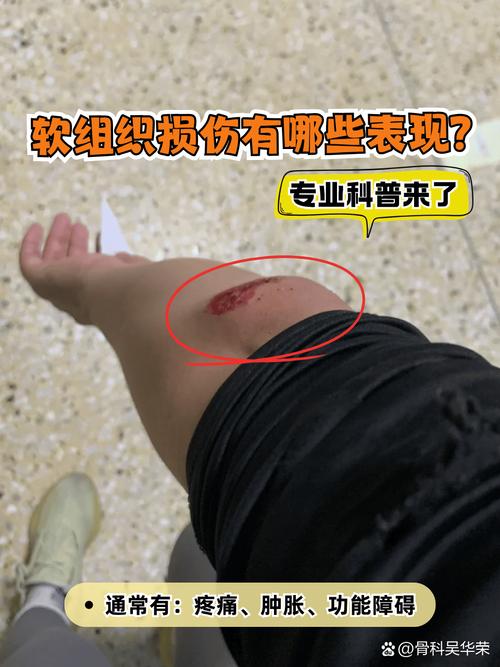 同一位置受伤,不同公司责任如何划分?-图2 同一位置受伤,不同公司责任如何划分?-图2